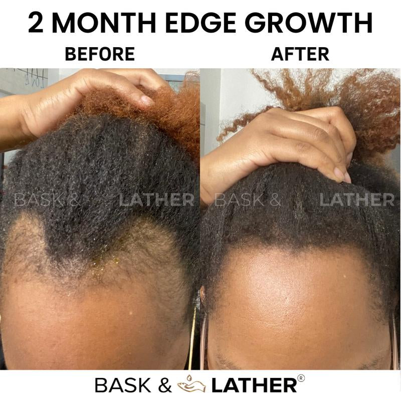 Scalp Stimulator & Hair Elixir Bundle: Growth & Length Retention with Castor Oil, Peppermint, and Rosemary - Natural Heat Protectant Treatment