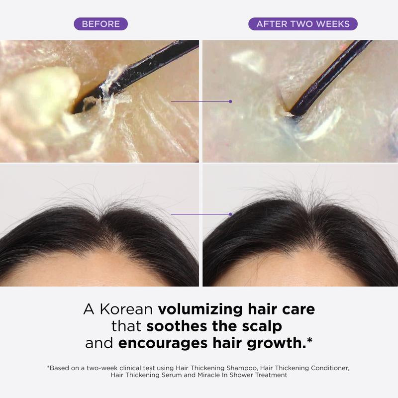 Dr. Groot Complete Set to Reduce Hair Loss, Scalp Revitalizing Solution, Hair Thickening, Biotin