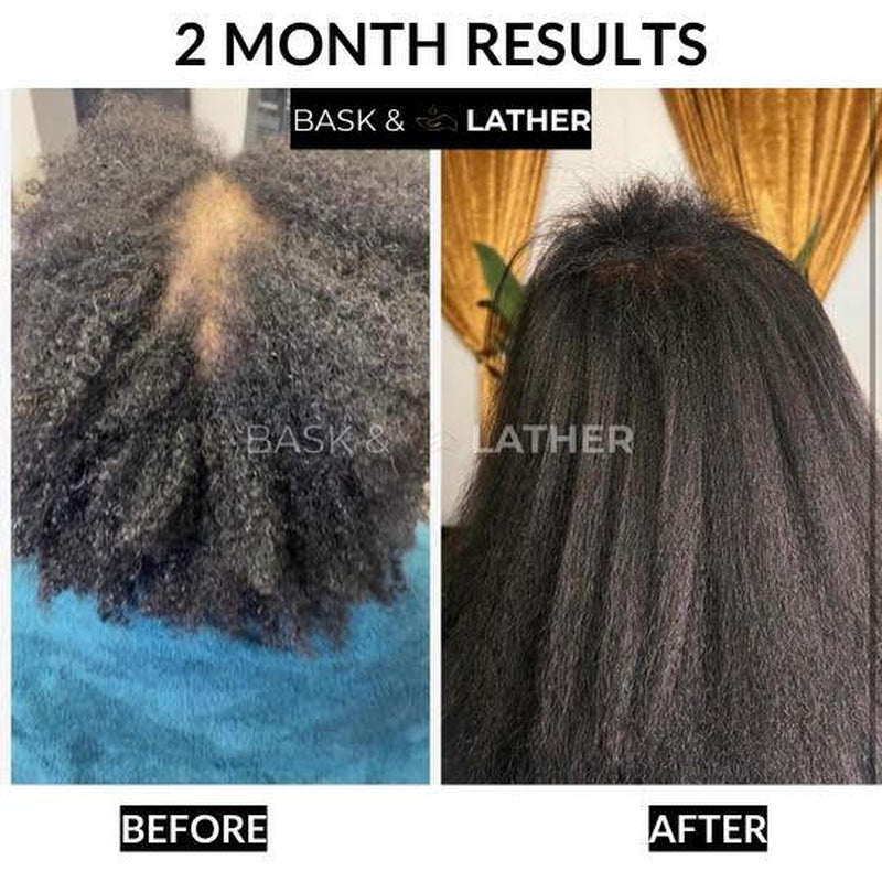 Scalp Stimulator & Hair Elixir Bundle: Growth & Length Retention with Castor Oil, Peppermint, and Rosemary - Natural Heat Protectant Treatment