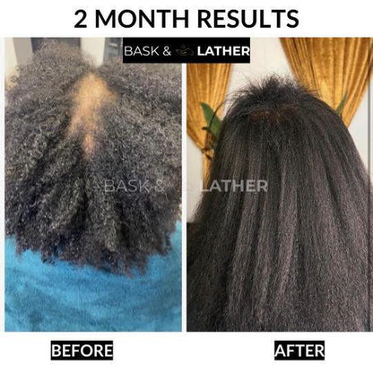 Scalp Stimulator & Hair Elixir Bundle: Growth & Length Retention with Castor Oil, Peppermint, and Rosemary - Natural Heat Protectant Treatment