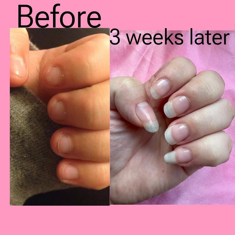 Aurora Moon Nail Growth Oil